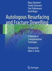Autologous Resurfacing and Fracture Dowelling