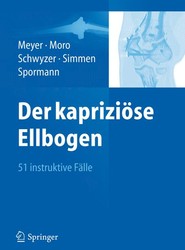 Der kaprizioese Ellbogen