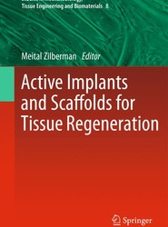 Active Implants and Scaffolds for Tissue Regeneration