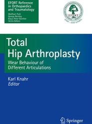 Total Hip Arthroplasty