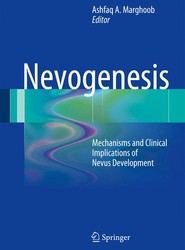 Nevogenesis