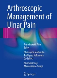 Arthroscopic Management of Ulnar Pain