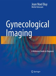 Gynecological Imaging