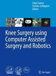 Knee Surgery using Computer Assisted Surgery and Robotics