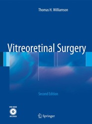 Vitreoretinal Surgery