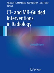 CT- and MR-Guided Interventions in Radiology