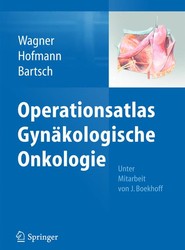 Operationsatlas Gynakologische Onkologie