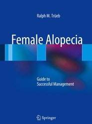 Female Alopecia