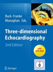 Three-dimensional Echocardiography
