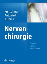 Nervenchirurgie