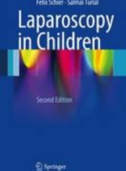 Laparoscopy in Children