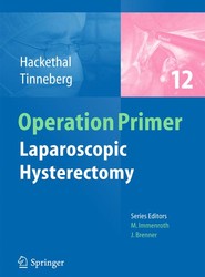 Laparoscopic Hysterectomy