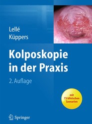 Kolposkopie in der Praxis