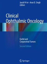 Clinical Ophthalmic Oncology