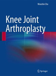 Knee Joint Arthroplasty