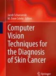 Computer Vision Techniques for the Diagnosis of Skin Cancer
