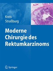 Moderne Chirurgie des Rektumkarzinoms