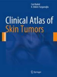 Clinical Atlas of Skin Tumors