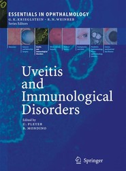 Uveitis and Immunological Disorders