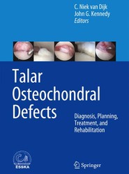 Talar Osteochondral Defects
