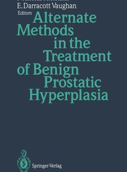 Alternate Methods in the Treatment of Benign Prostatic Hyperplasia