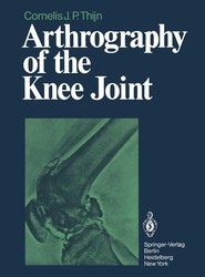 Arthrography of the Knee Joint