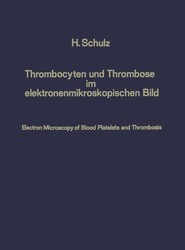 Thrombocyten und Thrombose im elektronenmikroskopischen Bild / Electron Microscopy of Blood Platelets and Thrombosis