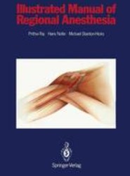 Illustrated Manual of Regional Anesthesia