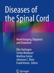 Diseases of the Spinal Cord
