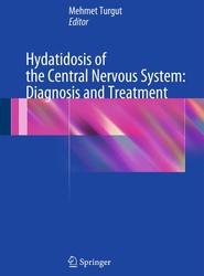 Hydatidosis of the Central Nervous System: Diagnosis and Treatment