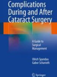 Complications During and After Cataract Surgery