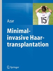 Minimalinvasive Haartransplantation