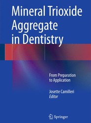 Mineral Trioxide Aggregate in Dentistry