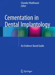Cementation in Dental Implantology