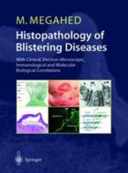 Histopathology of Blistering Diseases