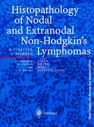 Histopathology of Nodal and Extranodal Non-Hodgkin's Lymphomas