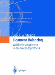 Ligament Balancing