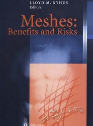 Meshes: Benefits and Risks