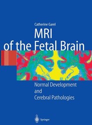 MRI of the Fetal Brain