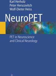 NeuroPET