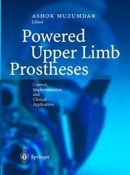 Powered Upper Limb Prostheses