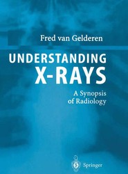 Understanding X-Rays