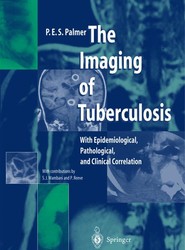 The Imaging of Tuberculosis