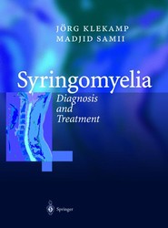 Syringomyelia