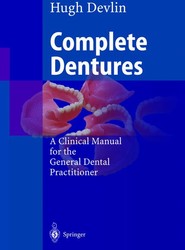 Complete Dentures