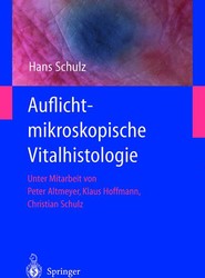 Auflichtmikroskopische Vitalhistologie