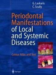 Periodontal Manifestations of Local and Systemic Diseases