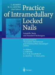Practice of Intramedullary Locked Nails