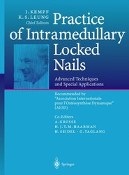 Practice of Intramedullary Locked Nails