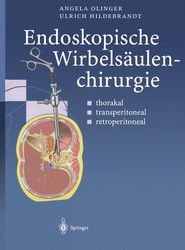 Endoskopische Wirbelsaulenchirurgie